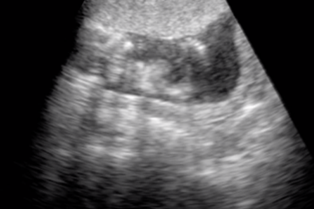 ポケマム1キット