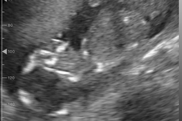 ポケマム2キット