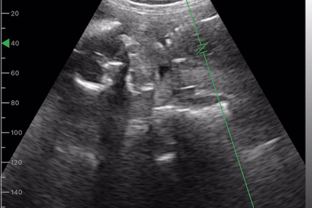 ポケマム・サウンズキット