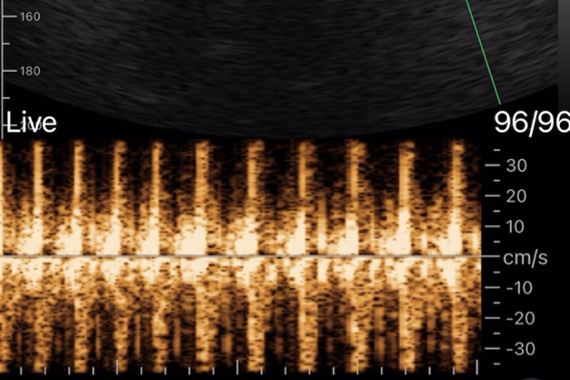 ポケマム・サウンズキット